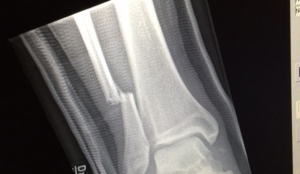 X-ray. Illustrative photo. (PIN)